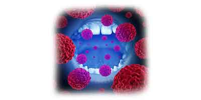 Oral Pathology